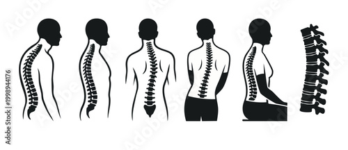 Spine posture and alignment set, human backbone anatomy icons, chiropractic and orthopaedic medical illustration, back pain symptoms, scoliosis and kyphosis curvature, sitting and standing human healt