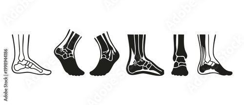 Human Foot Anatomy Icons Set, Ankle and Bone Structure Vector Illustration, Medical Skeletal System Diagrams for Orthopedic Healthcare and Foot Health Education, Flat Black Silhouette Design Elements