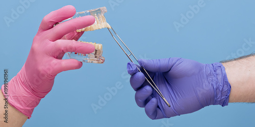 Photos Dental prosthetics and extraction mockup