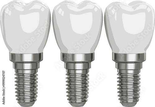 Dental implants set realistic tooth prosthesis vector illustration medical dentistry replacement screws for oral healthcare and implantology design