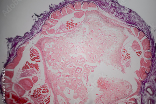 Microscope view of a cross-section of tissue stained in pink and purple with muscle-like fibers, cavities, and layered cell textures.