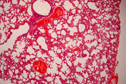 Принти на полотні Microscopically stained section of lung tissue showing alveolar spaces, branching red blood vessels, and cellular structures