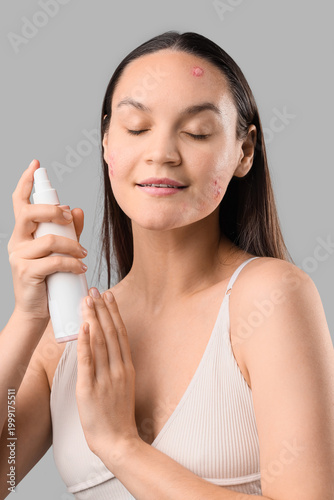 Φωτογραφία Young woman with acne problem holding medical spray on white background