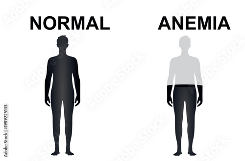 Normal and anemia icon. vector
