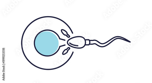 Medical illustration of human fertilization process showing a single sperm cell reaching an egg cell for conception.