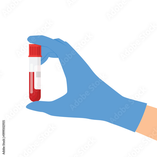 Healthcare professional in a protective blue glove holding a vital blood sample in a test tube for laboratory analysis and medical diagnosis
