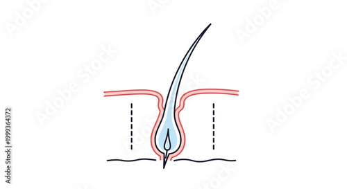 Educational color diagram showing a hair follicle cross-section with the root, bulb, and hair shaft within the skin layers.