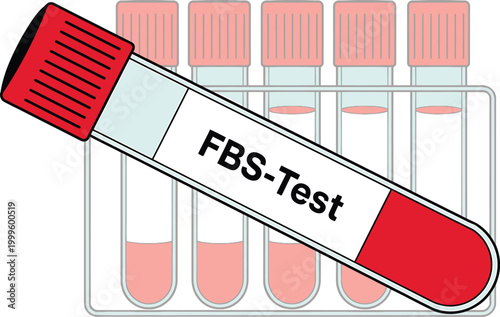 Medical test tube with blood sample labeled FBS-Test isolated on white background