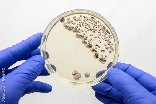 Photos A large petri dish with colonies of bacteria from white nalta, the petri dish holds the teacher, krpnіm plan on the gray background