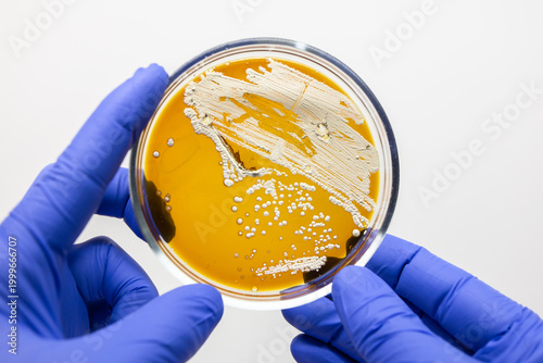Canvas Print White plaque of actinobacteria on a brown Gause medium, a scientist holds a Petri dish with actinobacteria in his hand