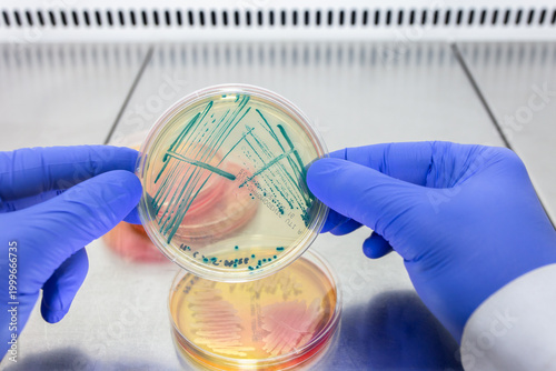 Foto A scientist holds a petri dish with pseudomanada colonies in both gloved hands, against the background of other petri dishes with bacteria
