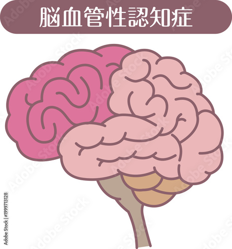 Vascular dementia brain illustration line