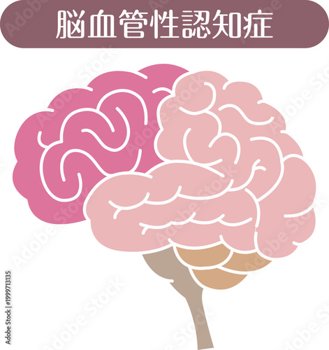 Vascular dementia brain illustration flat