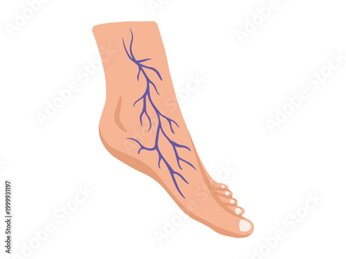 Hand Drawn Varices Foot Illustration

