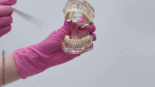 Dentist in Pink Gloves Pointing at Dental Implants on Transparent Jaw Model
