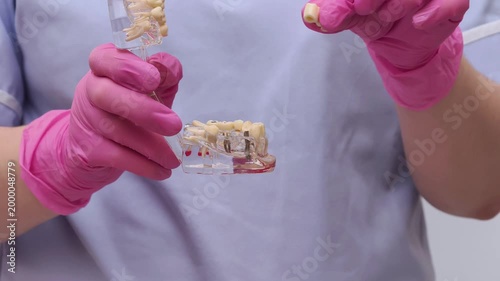 Dental Implant Model Demonstration by Technician in Gloves