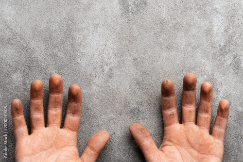 Dirty Hands Resting On Sparkling Sand Showing Cleanliness And Contrast