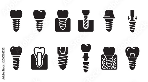 Collection of black and white vector icons illustrating dental implant procedures, components, and related tools, ideal for medical and dental industry use.