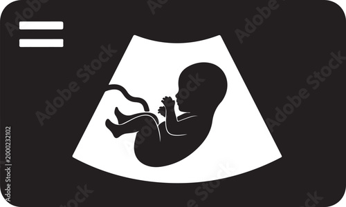 Black silhouette of a fetal ultrasound scan displaying a baby in the womb, symbolizing pregnancy, new life, and medical imaging technology.