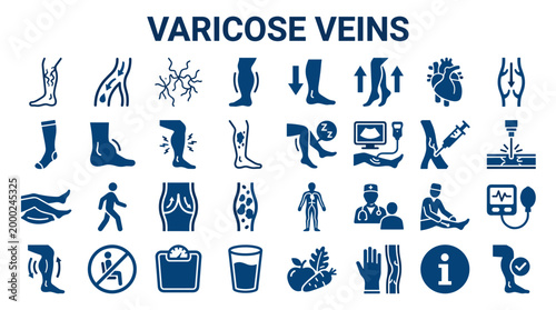 Varicose Veins Medical Icons Set Showing Symptoms Causes Diagnosis Treatment and Prevention Healthcare Concepts