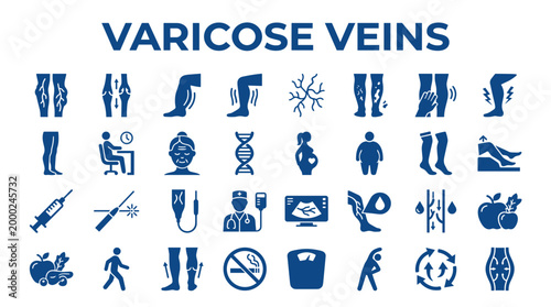 Varicose Veins Medical Condition Icons and Illustrations Showing Symptoms Causes Treatments and Prevention Methods for Healthy Legs