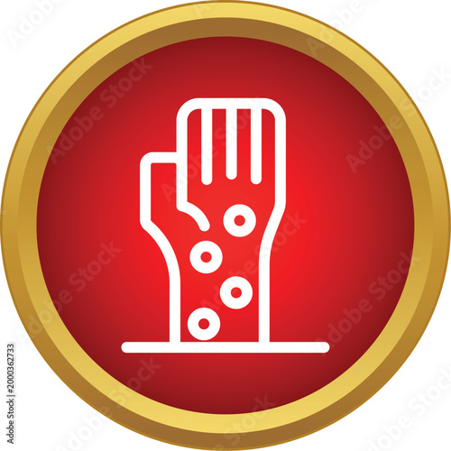 Hand showing skin irritation, a common allergic reaction or medical condition