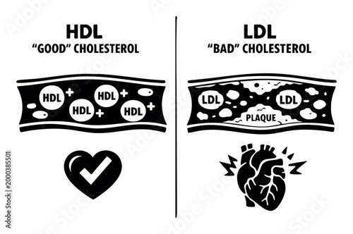 Explaining the difference between good and bad cholesterol, illustrating clear blood flow with HDL and plaque buildup with LDL
