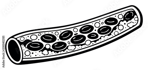 Atherosclerosis illustration depicting a narrowed artery with plaque and cholesterol obstructing red blood cells, impacting circulation