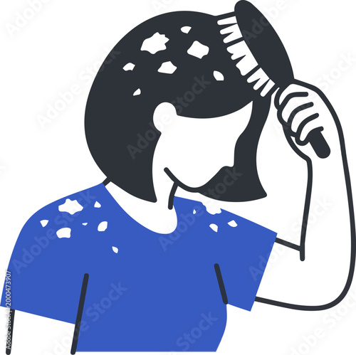 Woman brushing hair with dandruff flakes on scalp and shoulders for hair care and dermatology concept