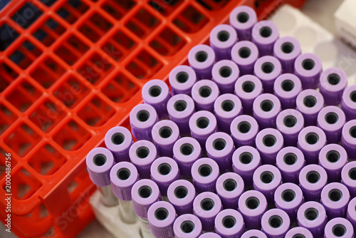 Test tubes in the medical laboratory, top view. Concept of research, health care, blood test, donation