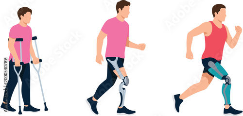 Prosthetic leg recovery stages, disabled athlete walking running, rehabilitation progress, mobility support, healthcare therapy, adaptive lifestyle, disability inclusion concept illustration