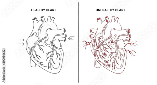 Healthy versus Unhealthy Human Heart.