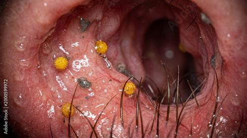 Hidden world inside a human nostril showcasing vibrant yellow pollen and fine dust trapped by protective hairs and sticky mucus