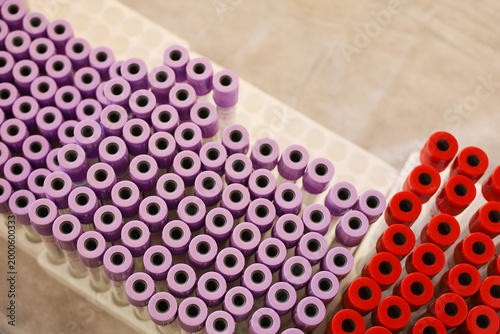 Test tubes in the medical laboratory, top view. Concept of research, health care, blood test, donation