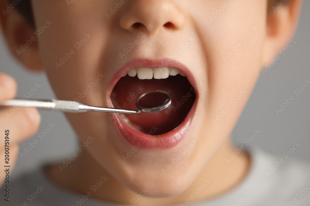 Fototapeta premium Dental explorer checkup on young patient