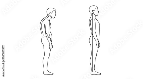 Comparison of good posture and bad posture in a human silhouette.