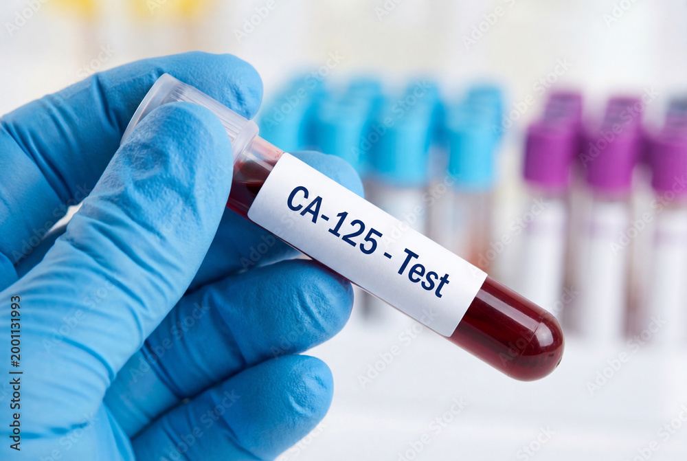 Obraz premium Medical professional holding CA 125 test blood sample tube