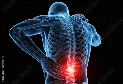 Male skeleton back view displaying lower back pain and inflammation with glowing nerve ache affecting body health.
