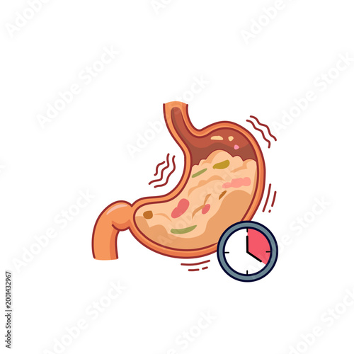 Gastroparesis Concept Illustration, Delayed Stomach Emptying and Digestive Disorder