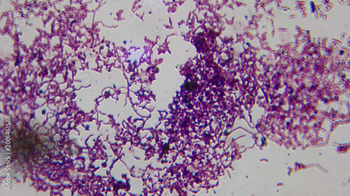 Fotografi Candida Pseudohyphae and Yeast Cells Stained Microscopy Sli