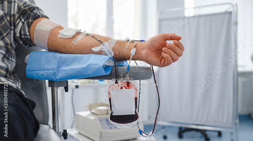 Konstfotografi Person donating blood in a modern clinic, showing the arm with an IV line connected to a blood collection bag