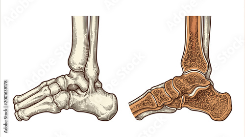 Anatomical illustration showcasing the skeletal structure of the human foot and ankle from lateral views, highlighting bones and joints.