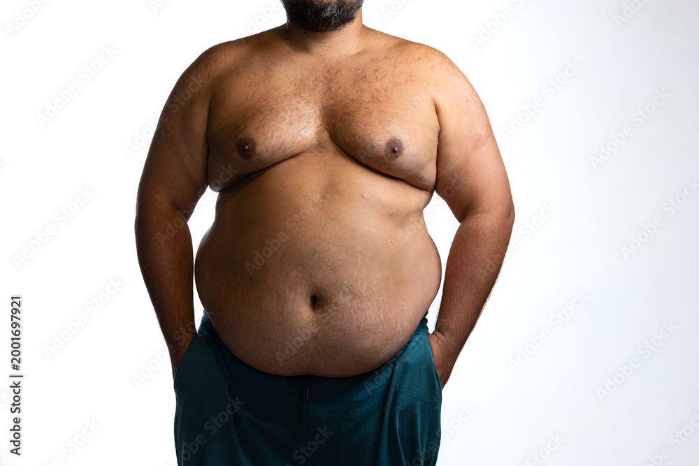 Naklejka premium Overweight man with abdominal obesity