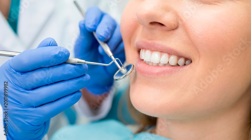 A close-up of a woman's bright white smile during a routine dental examination with a dentist's instruments