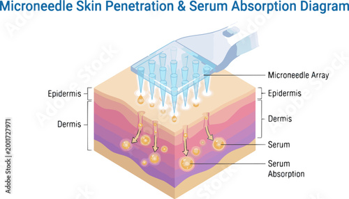 Create a realistic Microneedle Skin Penetration Showing Serum Absorption 3D Diagram vector art with white background.