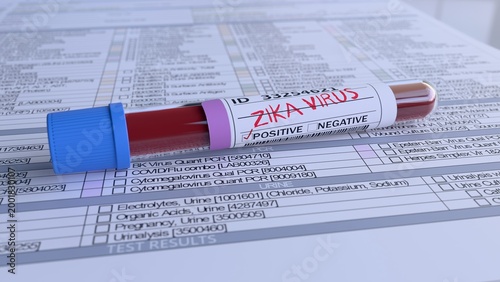 ZIKA Virus Test Positive Blood Test Result