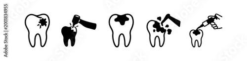 Set of black and white icons illustrating dental treatment steps: from identifying a cavity to drilling, cleaning decay, and applying a filling. Ideal for dental clinic infographics.