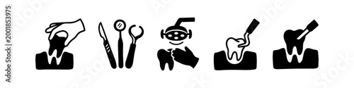 Set of black dental surgery and stomatology icons on white background. Vector illustrations showing tooth extraction, medical tools, examination, scaling, and anesthesia.