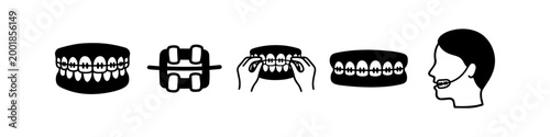 Set of black and white orthodontic icons featuring dental braces, brackets, rubber bands application, and headgear appliance for dental health and corrective treatment concepts.