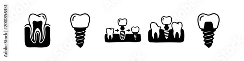 Set of dental implant icons illustrating tooth anatomy, the replacement process, and prosthodontics in a minimalist black and white style. Ideal for dentistry and oral health visual content.